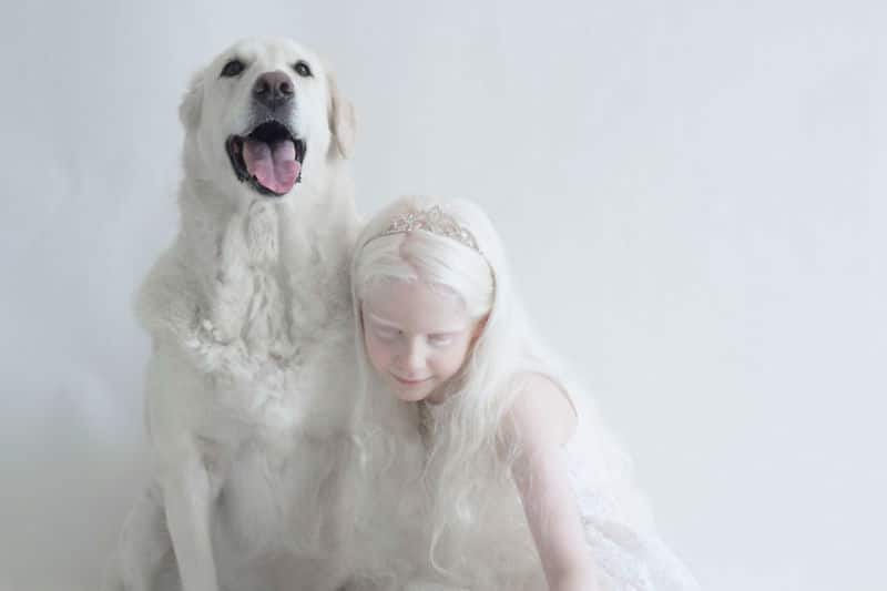 albino-people001