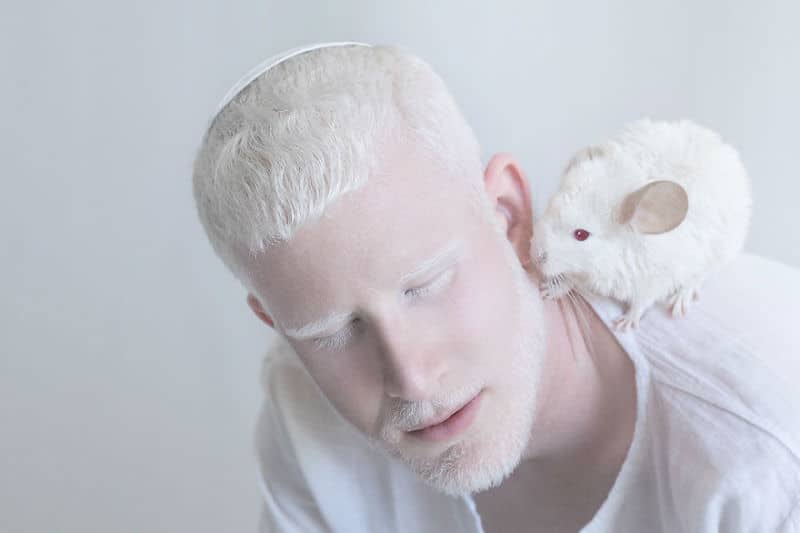 albino-people006