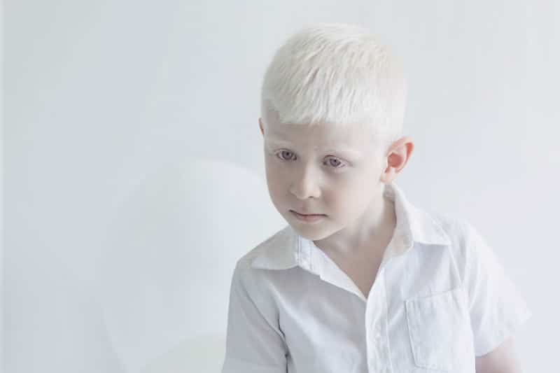 albino-people009