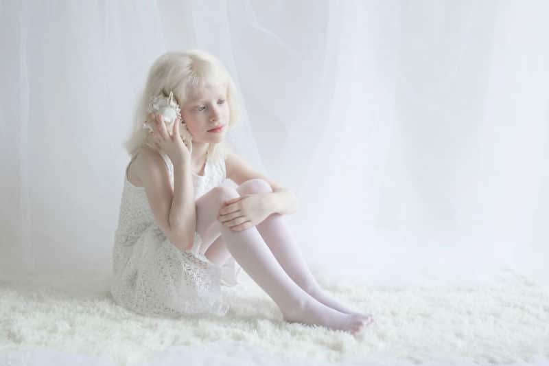 albino-people010